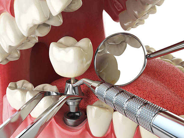 Best Urgent Tooth Repair  in Curtice, OH